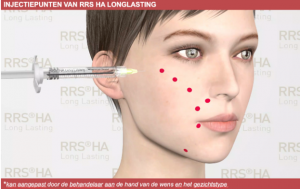 Rrs Ha Injectable RRS® HA Long Lasting - Skin Tech Pharma Group BNLX